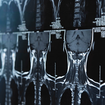 Neurosurgery – A Comprehensive Review 2021 (Videos)